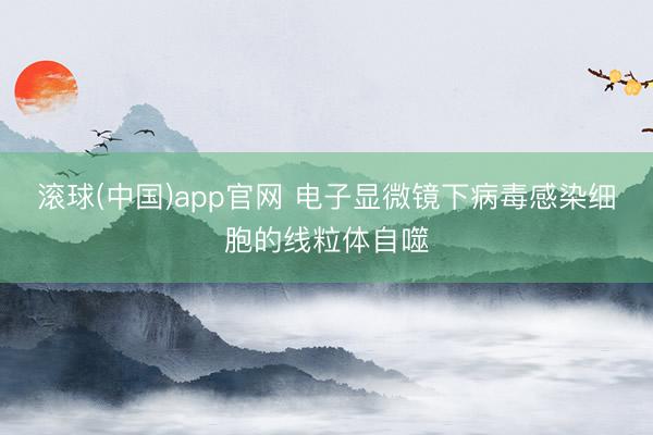 滚球(中国)app官网 电子显微镜下病毒感染细胞的线粒体自噬